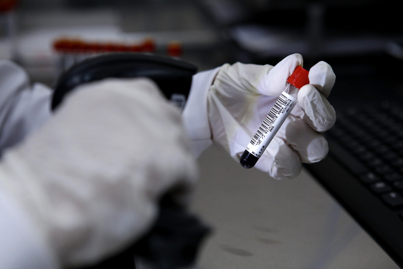 HRSM tem aumento de 1.823% nos exames para dengue em fevereiro