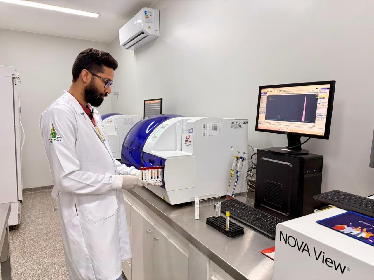 Saúde implanta novo exame de sangue na rede pública do DF