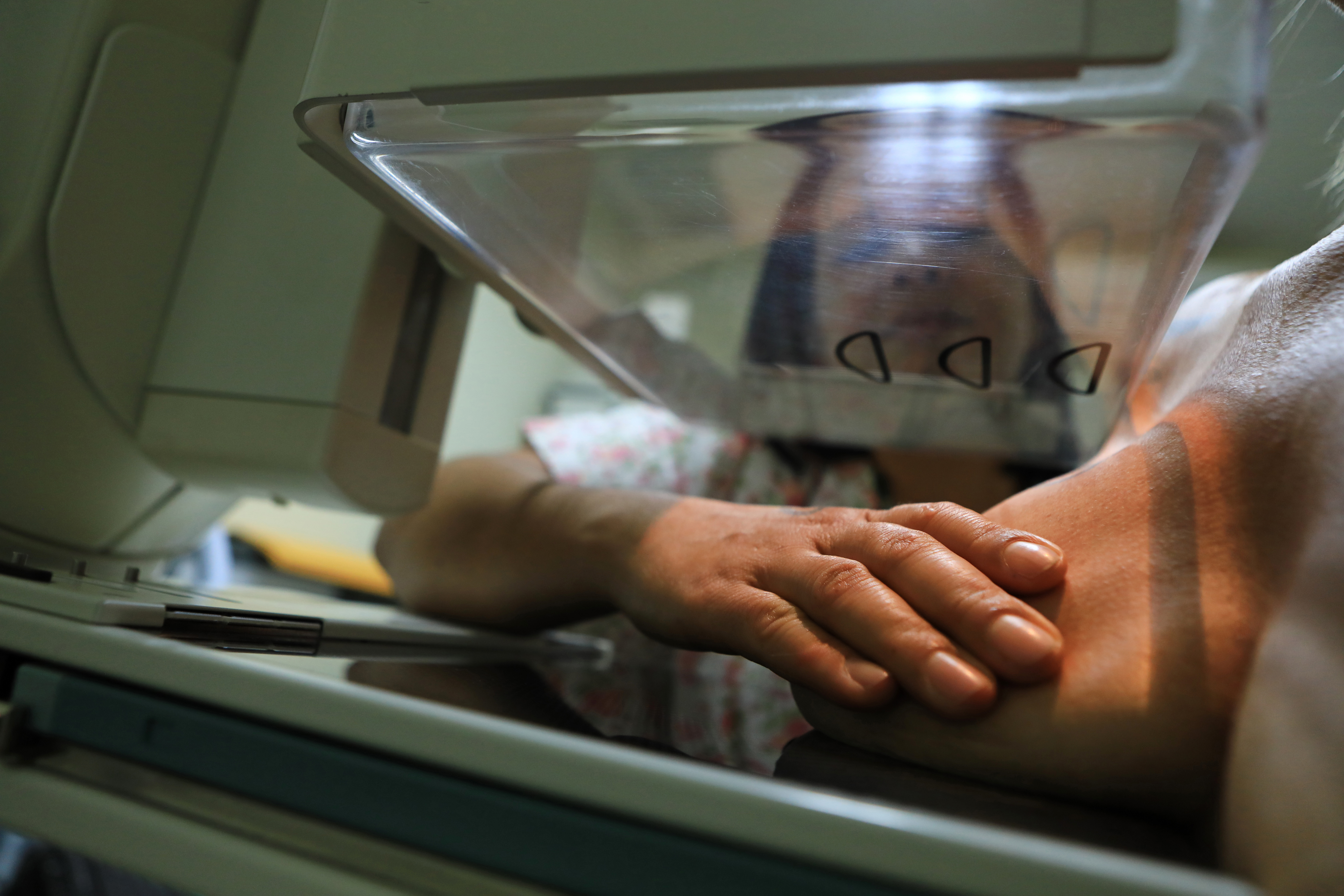 Número de mamografia cresce 21,8% na rede pública do DF