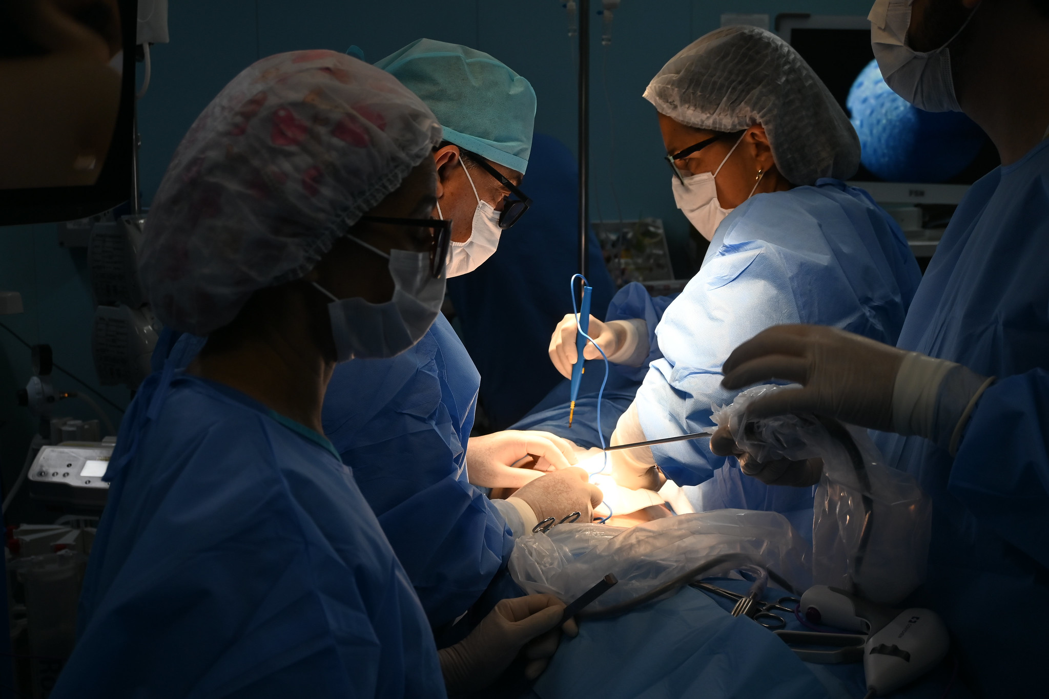 Hospital de Base recebe etapa final de curso internacional de cirurgia torácica com tecnologia 3D