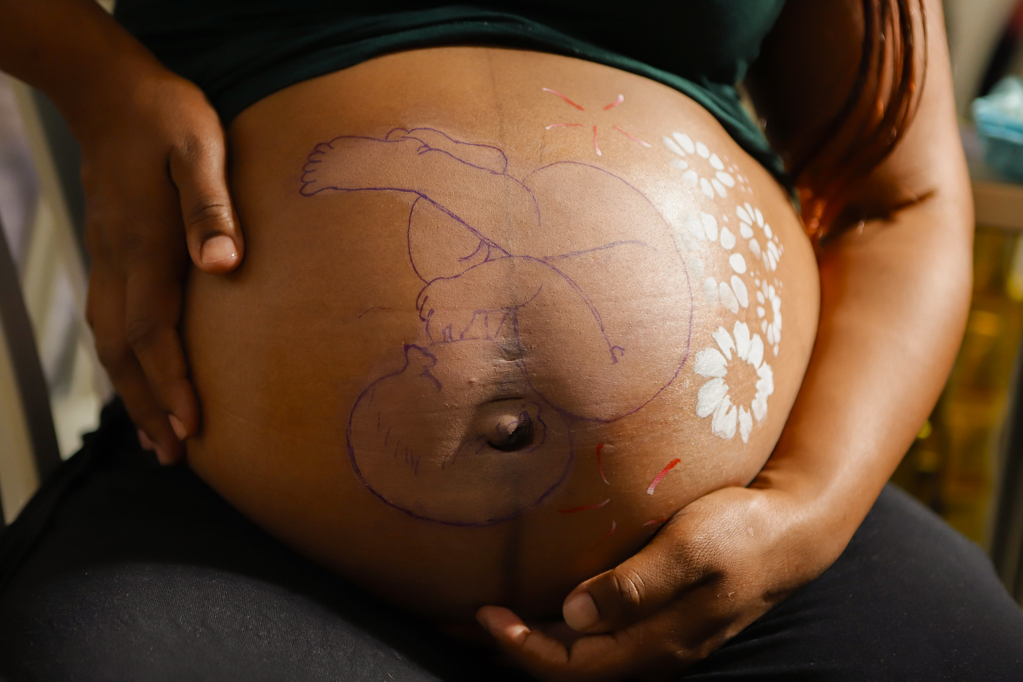 DF registra menor proporção de casos de gravidez na adolescência