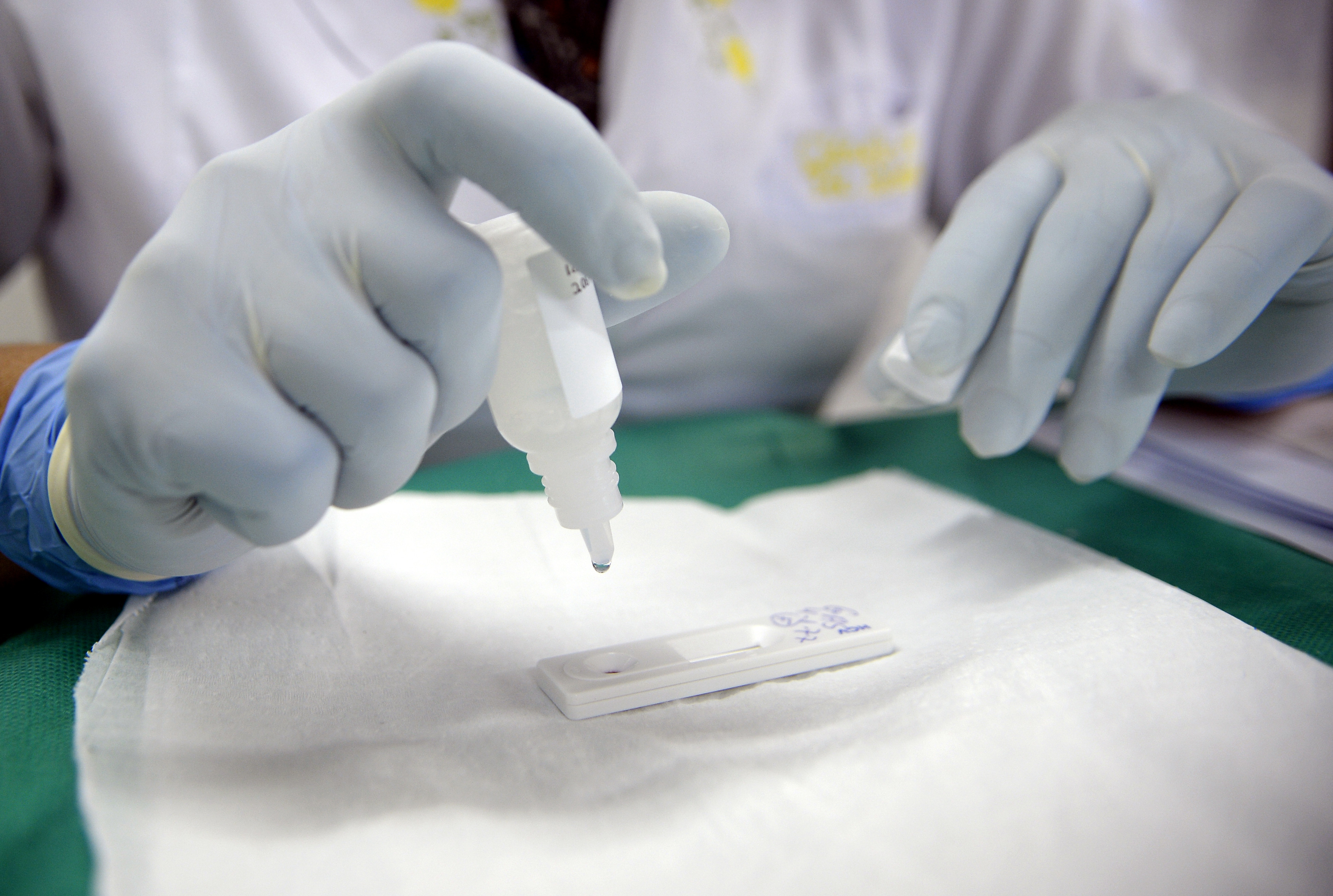 Casos de sífilis diminuem no Distrito Federal; diagnóstico precoce é fundamental para tratamento