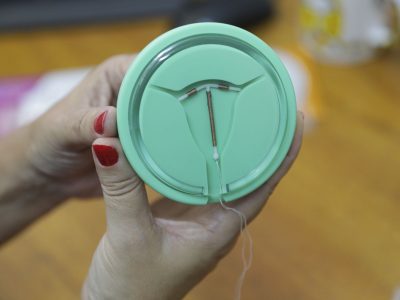 Inserção de DIU aumenta 38,7% após procedimento ser realizado por enfermeiros da rede pública