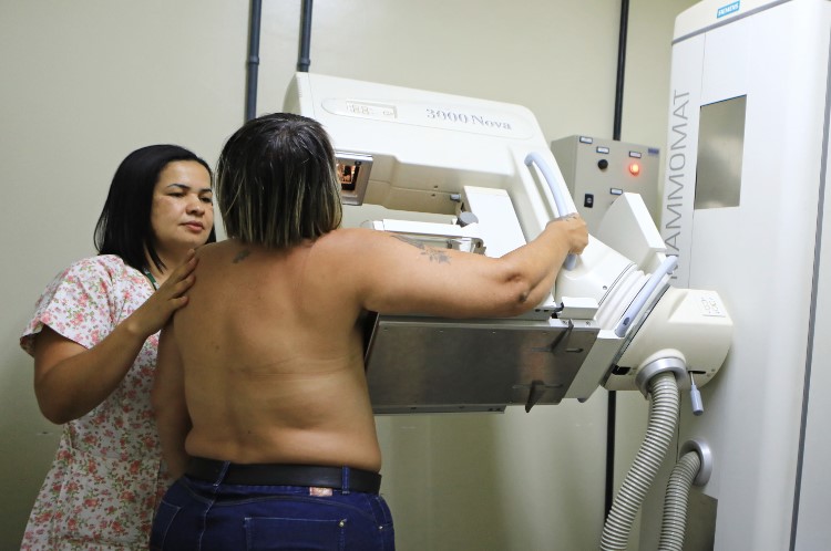 Rede pública de saúde do DF realizou mais de 5 mil mamografias de janeiro a março