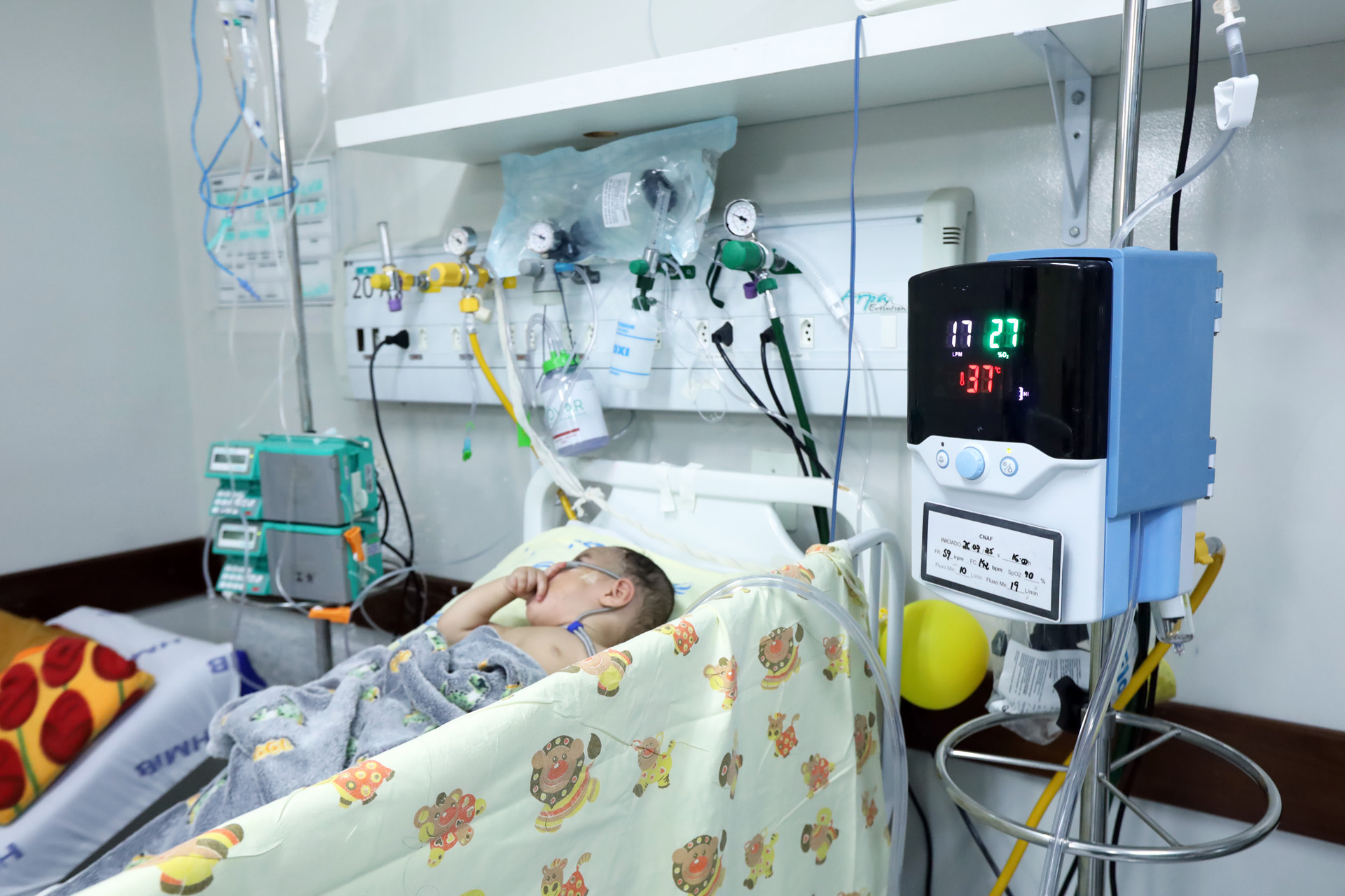 Novos cateteres nasais de alto fluxo reforçam atendimento pediátrico na rede pública