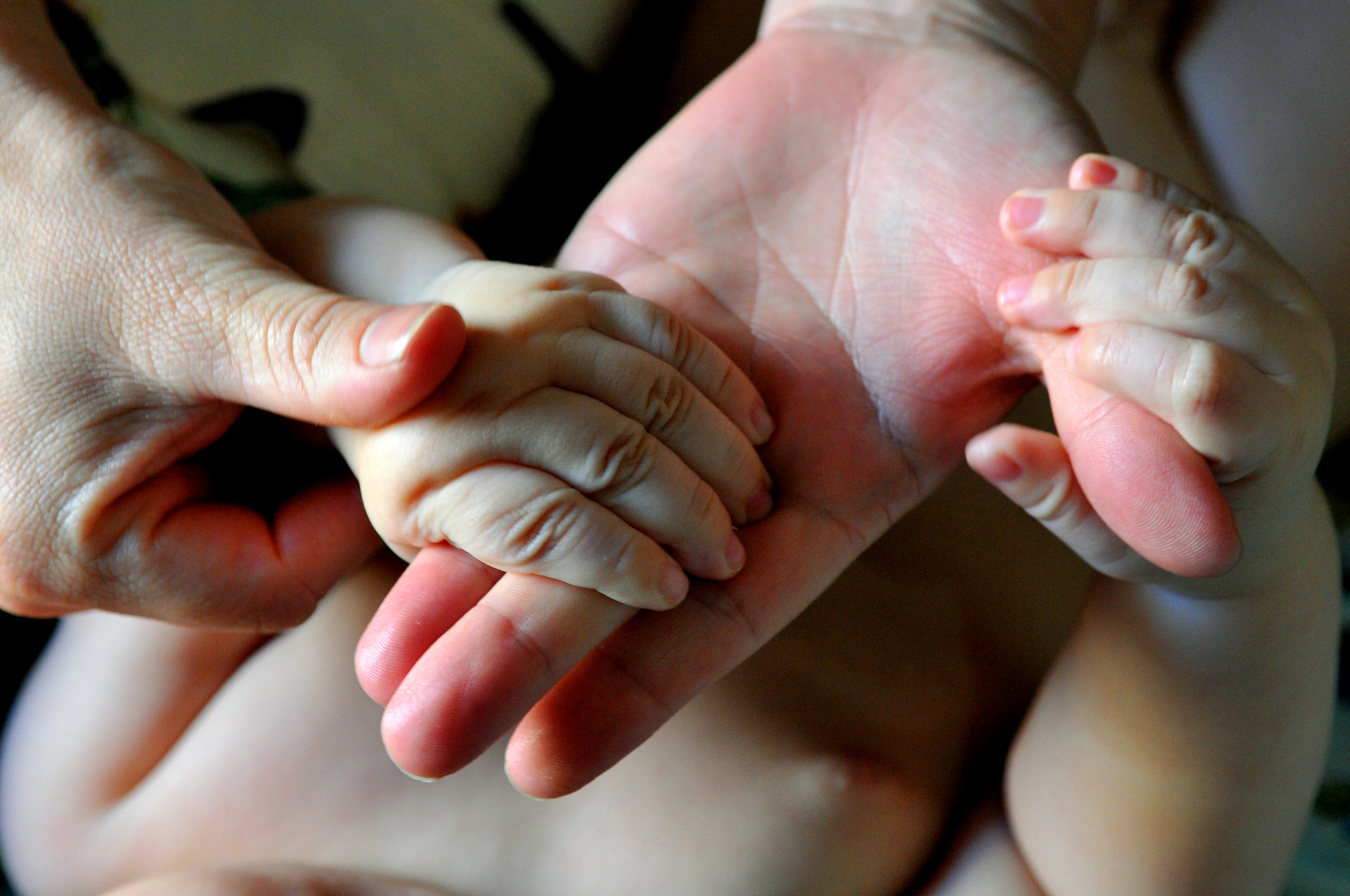 Doença mão-pé-boca: Pais devem redobrar atenção no ambiente escolar