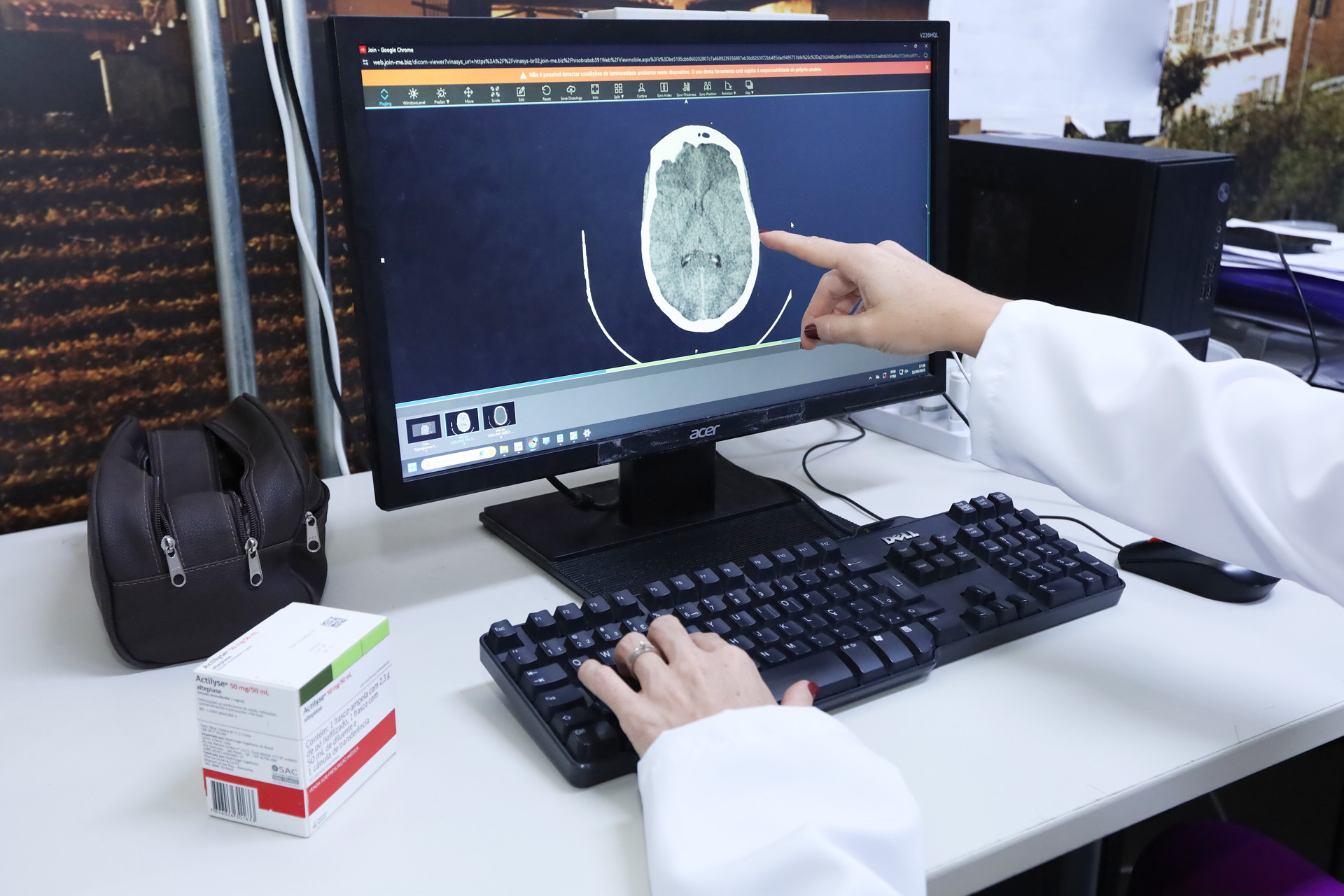 Acidente Vascular Cerebral: com Programa AVC no Quadrado, GDF amplia assistência emergencial