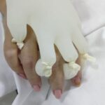 Além do bem-estar, o método facilita averiguar o quadro clínico, já que as luvas ajudam a esquecer as mãos dos pacientes para que se possa medir o grau de saturação de oxigênio| Foto: Divulgação/Iges-DF