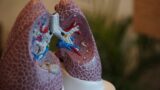 A fibrose pulmonar surge como sequela de diferentes doenças caracterizadas pela destruição progressiva e irreversível da arquitetura do pulmão, a exemplo da covid-19 | Imagem: Divulgação/FAP-DF